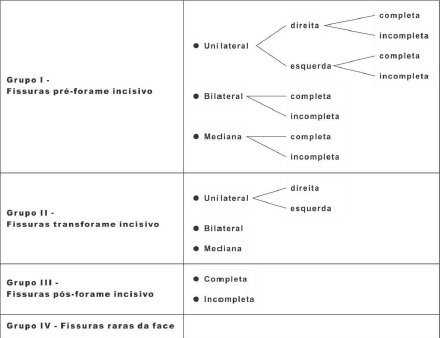 Figura 2 - Tipos de fissuras orofaciais segundo a classificação de Spina et al (1972), modificada por Silva-Filho et al (1992) Fonte: Trindade e Silva Filho (2007)